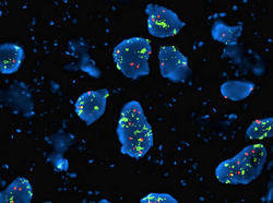 Détection eds mutations par marquage fluorescent sur les noyaux cellulaires. Technique de FISH (Hybridation in situ en fluorescence)